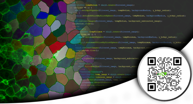 Basic Microscopic Image Processing and Analysis - CPI online – Cardio ...